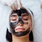 Лазерная карбоновая чистка